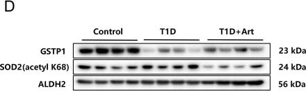 Fig.2.D showing Western Blotting in a Mus musculus (House mouse) sample from the publication: Artemether ameliorates type 1 diabetic liver injury alongside the associated defects in mitochondrial ultrastructure and central carbon metabolism.
