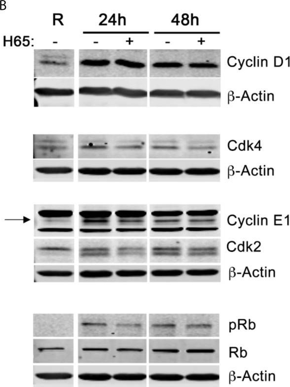 Fig.2.B showing Western Blotting in a Mus musculus (House mouse) sample from the publication: PRMT5 Promotes Cyclin E1 and Cell Cycle Progression in CD4 Th1 Cells and Correlates With EAE Severity.