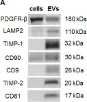 Fig.2.A showing Western Blotting from the publication: Extracellular vesicles from bone marrow mesenchymal stem/stromal cells transport tumor regulatory microRNA, proteins, and metabolites.