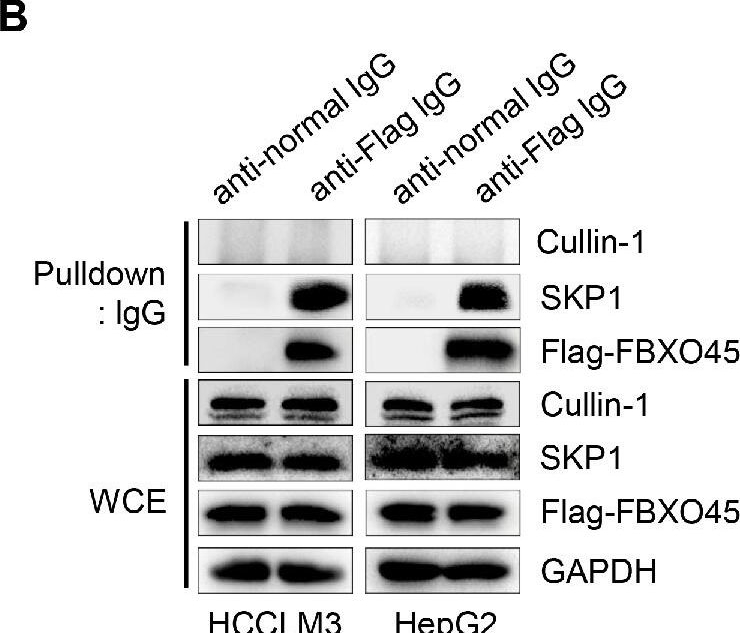 Fig.3.B showing Western Blotting from the publication: Elevated FBXO45 promotes liver tumorigenesis through enhancing IGF2BP1 ubiquitination and subsequent PLK1 upregulation.