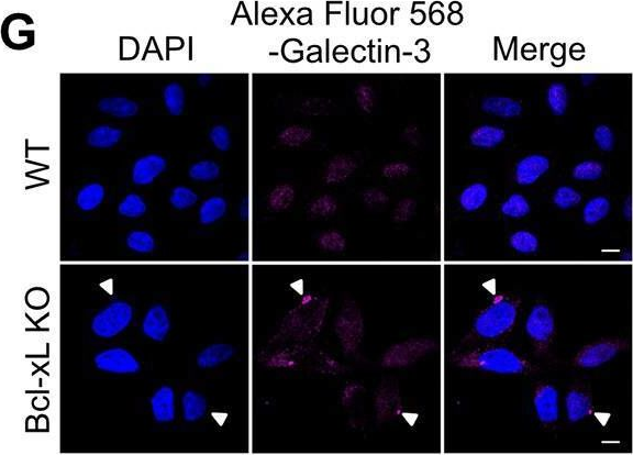 Fig.2.G showing Immunocytochemistry-immunofluorescence from the publication: Bcl-xL Affects Group A Streptococcus-Induced Autophagy Directly, by Inhibiting Fusion between Autophagosomes and Lysosomes, and Indirectly, by Inhibiting Bacterial Internalization via Interaction with Beclin 1-UVRAG.