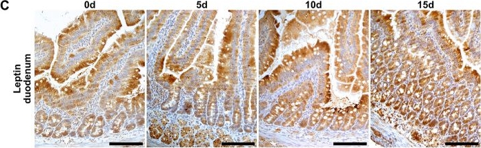 Fig.4.C showing Immunohistochemistry from the publication: Maternal acrylamide exposure changes intestinal epithelium, immunolocalization of leptin and ghrelin and their receptors, and gut barrier in weaned offspring.
