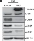 Fig.1.A showing Western Blotting from the publication: EPS8 phosphorylation by Src modulates its oncogenic functions.