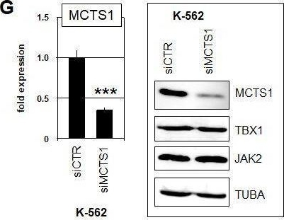 Fig.1.G showing Western Blotting in a Homo sapiens (Human) sample from the publication: Aberrant expression of MAPK1 and MCTS1 in chronic myeloid leukemia (CML).