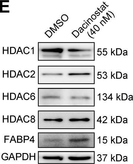 Fig.7.E showing Western Blotting in a Homo sapiens (Human) sample from the publication: The peroxisome proliferator-activated receptor agonist rosiglitazone specifically represses tumour metastatic potential in chromatin inaccessibility-mediated FABP4-deficient gastric cancer.