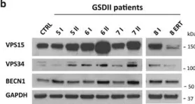 Fig.3.B showing Western Blotting in a Homo sapiens (Human) sample from the publication: Autophagy dysregulation in Danon disease.