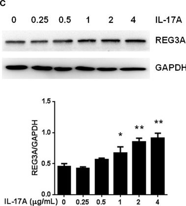 Fig.4.C showing Western Blotting in a Homo sapiens (Human) sample from the publication: Reduced miR-146a Promotes REG3A Expression and Macrophage Migration in Polymyositis and Dermatomyositis.