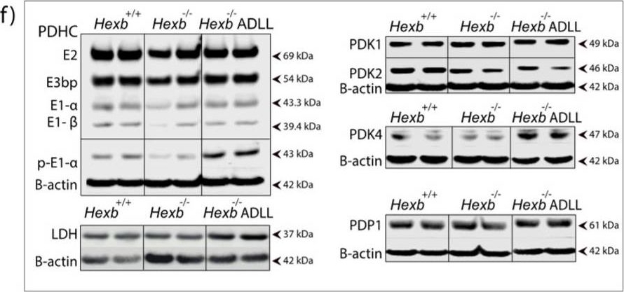 Fig.4.F showing Western Blotting in a Mus musculus (House mouse) sample from the publication: Beneficial Effects of Acetyl-DL-Leucine (ADLL) in a Mouse Model of Sandhoff Disease.