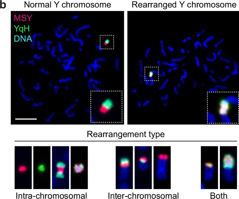 Fig.1.B showing Immunocytochemistry-immunofluorescence in a Homo sapiens (Human) sample from the publication: Non-homologous end joining shapes the genomic rearrangement landscape of chromothripsis from mitotic errors.
