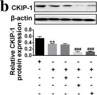 Fig.3.B showing Western Blotting in a Homo sapiens (Human) sample from the publication: Upregulation of CKIP-1 inhibits high-glucose induced inflammation and oxidative stress in HRECs and attenuates diabetic retinopathy by modulating Nrf2/ARE signaling pathway: an in vitro study.