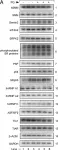 Fig.6.A showing Western Blotting from the publication: Oxidative Stress Triggers Body-Wide Skipping of Multiple Exons of the Spinal Muscular Atrophy Gene.