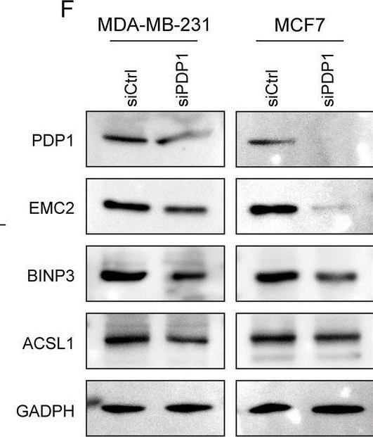 Fig.6.F showing Western Blotting in a Homo sapiens (Human) sample from the publication: PDP1 related ferroptosis risk signature indicates distinct immune microenvironment and prognosis of breast cancer patients.