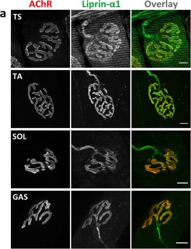 Fig.2.A showing Immunohistochemistry-immunofluorescence in a Mus musculus (House mouse) sample from the publication: Liprin-α-1 is a novel component of the murine neuromuscular junction and is involved in the organization of the postsynaptic machinery.