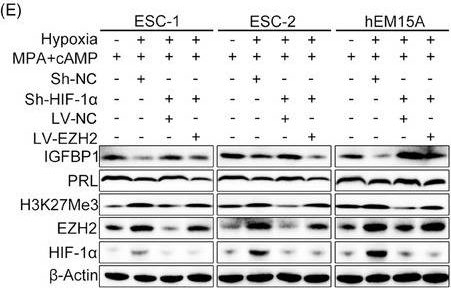 Fig.2.E showing Western Blotting from the publication: The involvement of RNA N6-methyladenosine and histone methylation modification in decidualization and endometriosis-associated infertility.