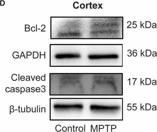 Fig.7.D showing Western Blotting in a Mus musculus (House mouse) sample from the publication: A Pilot Study on a Possible Mechanism behind Olfactory Dysfunction in Parkinson's Disease: The Association of TAAR1 Downregulation with Neuronal Loss and Inflammation along Olfactory Pathway.
