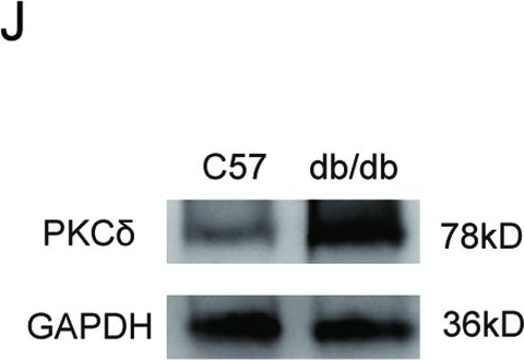 Fig.1.J showing Western Blotting in a Mus musculus (House mouse) sample from the publication: Upregulation of rate-limiting enzymes in cholesterol metabolism by PKCδ mediates endothelial apoptosis in diabetic wound healing.
