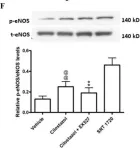 Fig.4.F showing Western Blotting from the publication: Effects of Cilostazol on Angiogenesis in Diabetes through Adiponectin/Adiponectin Receptors/Sirtuin1 Signaling Pathway.