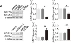 Fig.4.A showing Western Blotting from the publication: USP15 regulates p66Shc stability associated with Drp1 activation in liver ischemia/reperfusion.