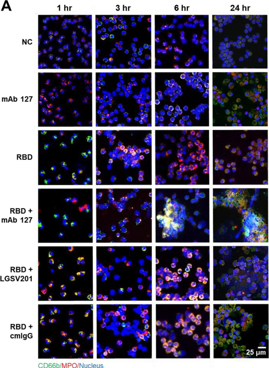 Fig.3.A showing Immunocytochemistry-immunofluorescence in a Homo sapiens (Human) sample from the publication: Enhancement of NETosis by ACE2-cross-reactive anti-SARS-CoV-2 RBD antibodies in patients with COVID-19.