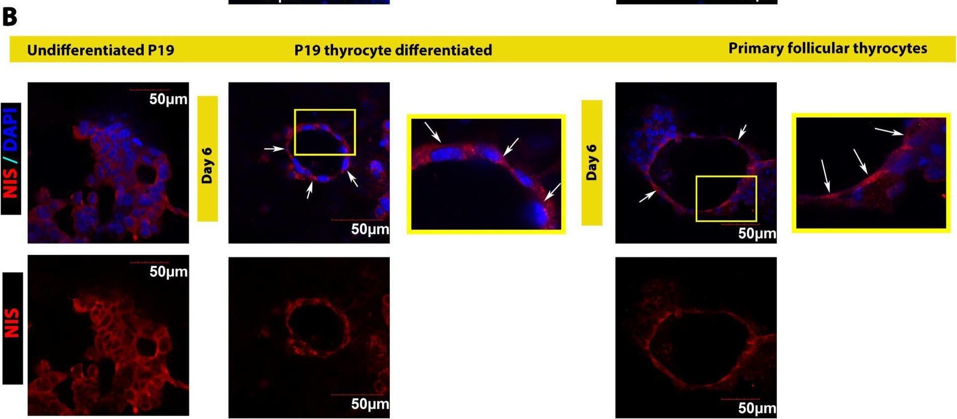 Fig.4.B from the publication: Modelling Functional Thyroid Follicular Structures Using P19 Embryonal Carcinoma Cells.