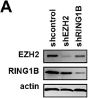Fig.6.A showing Western Blotting in a Homo sapiens (Human) sample from the publication: Biphasic euchromatin-to-heterochromatin transition on the KSHV genome following de novo infection.