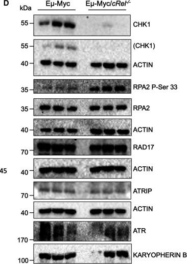 Fig.3.D showing Western Blotting from the publication: Regulation of CHK1 inhibitor resistance by a c-Rel and USP1 dependent pathway.