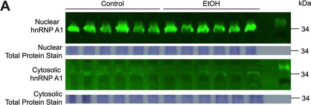 Fig.4.A showing Western Blotting from the publication: Ethanol induces subcellular trafficking of the RNA-binding protein, hnRNP A1, in neuronal cells in vitro, but not in the peripubertal rat brain.