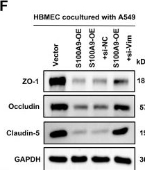 Fig.5.F showing Western Blotting from the publication: USP33 Promotes Lung Adenocarcinoma Brain Metastasis by Inhibiting the K48-Linked Ubiquitination and Degradation of S100A9 and Facilitating Vimentin Secretion.