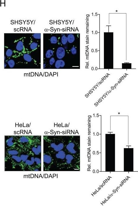 Tristetraprolin inhibits mitochondrial function through suppression of α-Synuclein expression in cancer cells.