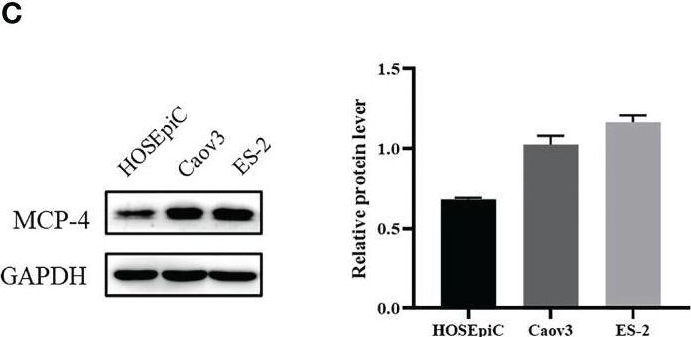 Fig.1.C showing Western Blotting in a Homo sapiens (Human) sample from the publication: Prognostic biomarker MCP-4 triggers epithelial-mesenchymal transition via the p38 MAPK pathway in ovarian cancer.