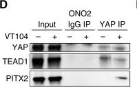 Fig.3.D showing Western Blotting from the publication: Aberrant Hippo-YAP/TEAD Signaling Drives Malignant Transcriptional Reprogramming in External Auditory Canal Squamous Cell Carcinoma.
