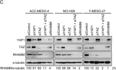 Fig.1.C showing Western Blotting in a Homo sapiens (Human) sample from the publication: Hyaluronic acid enhances cell migration and invasion via the YAP1/TAZ-RHAMM axis in malignant pleural mesothelioma.