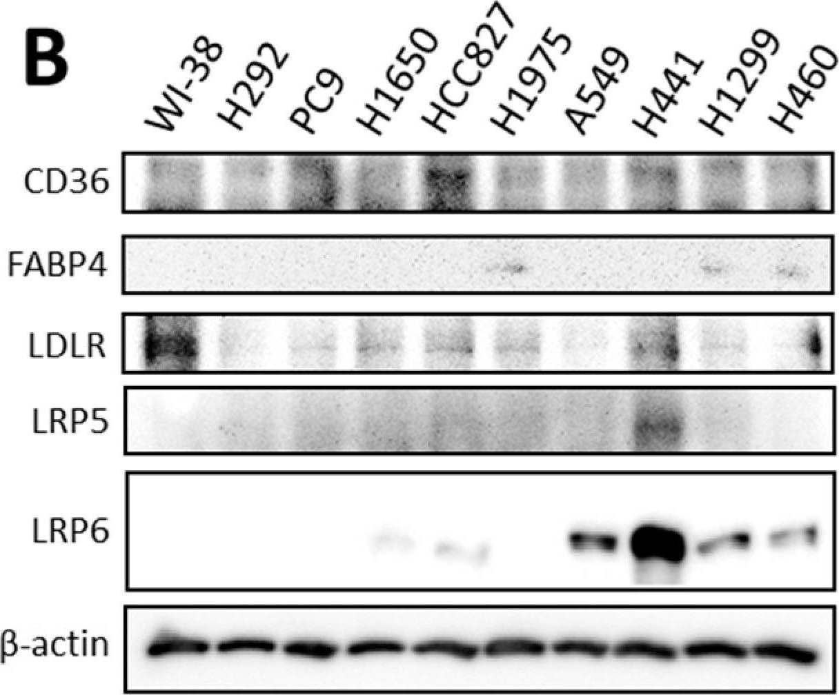 Fig.1.B showing Western Blotting in a Homo sapiens (Human) sample from the publication: Lipid Droplets in Lung Cancers Are Crucial for the Cell Growth and Starvation Survival.