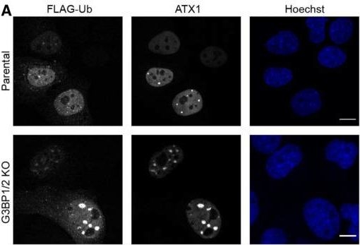 Fig.8.A showing Immunocytochemistry-immunofluorescence in a Homo sapiens (Human) sample from the publication: Cytosolic stress granules relieve the ubiquitin-proteasome system in the nuclear compartment.