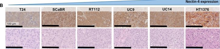 Fig.4.B showing Immunohistochemistry from the publication: Nectin-4 PET for predicting enfortumab vedotin dose-response in urothelial carcinoma.