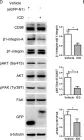 Fig.2.D showing Western Blotting from the publication: Dominant Suppression of β1 Integrin by Ectopic CD98-ICD Inhibits Hepatocellular Carcinoma Progression.