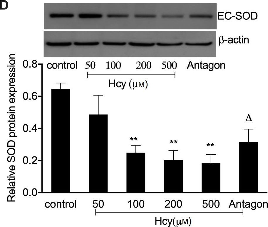 Fig.2.D showing Western Blotting from the publication: Extracellular-superoxide dismutase DNA methylation promotes oxidative stress in homocysteine-induced atherosclerosis.