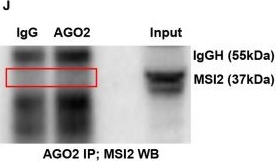 Fig.4.J showing Western Blotting from the publication: RNA-Binding Protein MSI2 Binds to miR-301a-3p and Facilitates Its Distribution in Mitochondria of Endothelial Cells.