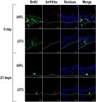 Fig.7.A showing Immunocytochemistry-immunofluorescence in a Homo sapiens (Human) sample from the publication: Irradiated Human Fibroblasts as a Substitute Feeder Layer to Irradiated Mouse 3T3 for the Culture of Human Corneal Epithelial Cells: Impact on the Stability of the Transcription Factors Sp1 and NFI.