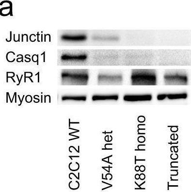 Fig.4.A showing Western Blotting in a Mus musculus (House mouse) sample from the publication: Variants in ASPH cause exertional heat illness and are associated with malignant hyperthermia susceptibility.