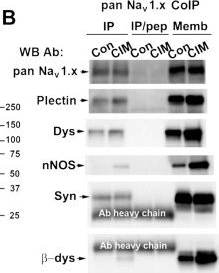 Fig.5.B showing Western Blotting in a Rattus norvegicus (Rat) sample from the publication: Altered sodium channel-protein associations in critical illness myopathy.