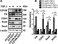 Fig.6.A showing Western Blotting from the publication: CD109 released from human bone marrow mesenchymal stem cells attenuates TGF-β-induced epithelial to mesenchymal transition and stemness of squamous cell carcinoma.