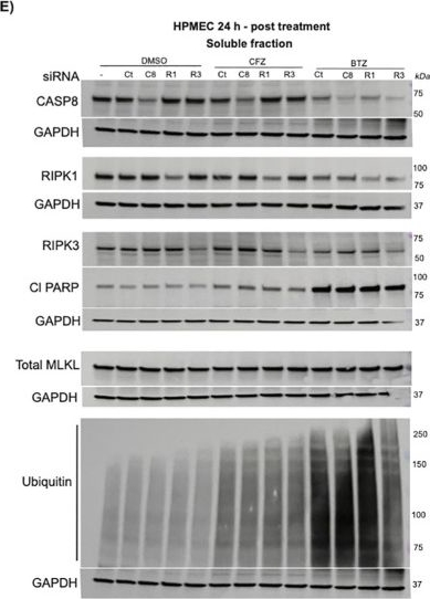 Fig.2.E showing Western Blotting in a Homo sapiens (Human) sample from the publication: Proteasomal inhibition compromises microvascular integrity via distinct effects on non-immune endothelial cells and immune cells.