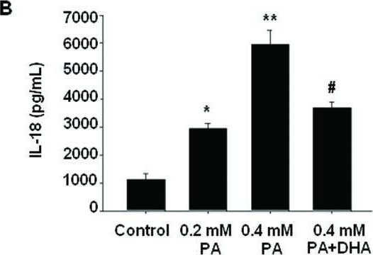 Fig.2.B showing Enzyme-linked immunosorbent assay from the publication: Docosahexaenoic acid ameliorates palmitate-induced lipid accumulation and inflammation through repressing NLRC4 inflammasome activation in HepG2 cells.