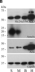 Fig.2.B showing Western Blotting from the publication: Multiple Calcium Export Exchangers and Pumps Are a Prominent Feature of Enamel Organ Cells.