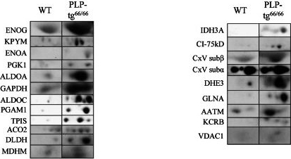 Fig.4.A showing Western Blotting in a Mus musculus (House mouse) sample from the publication: Oxidative stress and mitochondrial dynamics malfunction are linked in Pelizaeus-Merzbacher disease.