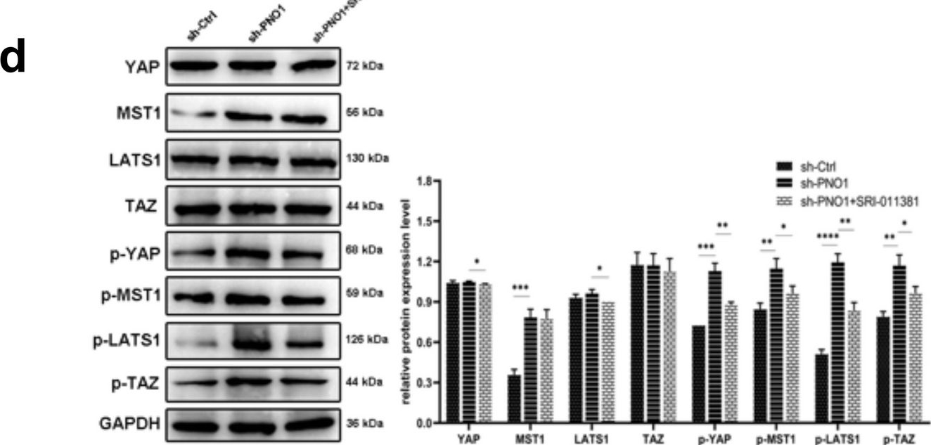 Fig.5.D showing Western Blotting from the publication: PNO1 promotes the progression of osteosarcoma via TGF-β and YAP/TAZ pathway.