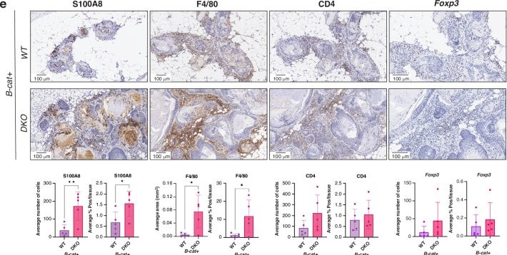 Fig.6.E showing Immunohistochemistry from the publication: Runx1 and Runx2 act in concert to suppress Wnt/β-catenin-driven mammary tumourigenesis.