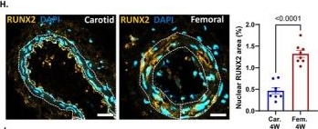 Fig.1.H showing Immunohistochemistry-immunofluorescence in a Homo sapiens (Human) sample from the publication: DDR1 Regulates Femoral Arterial Calcification in Lower-Extremity Artery Disease Through NF-Kappa B Activation.