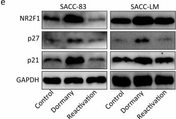 Fig.1.E showing Western Blotting from the publication: Cancer-associated fibroblast-derived extracellular vesicles regulate lipophagy through PLIN2 to modulate dormancy in salivary gland adenoid cystic carcinoma cells.
